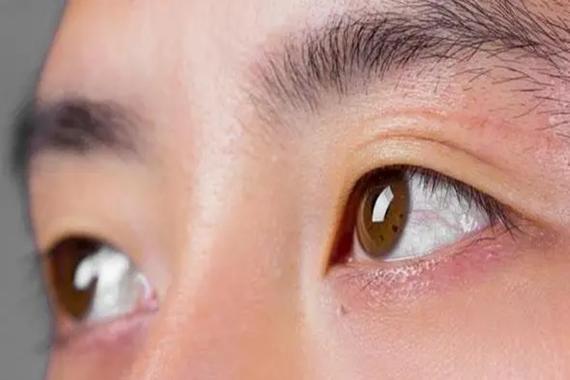 右眼皮跳测吉凶,左眼皮跳测吉凶星期